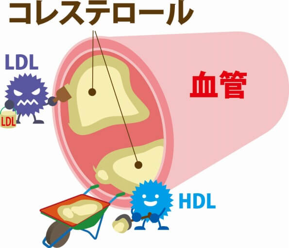 脂質異常症の検査と基準